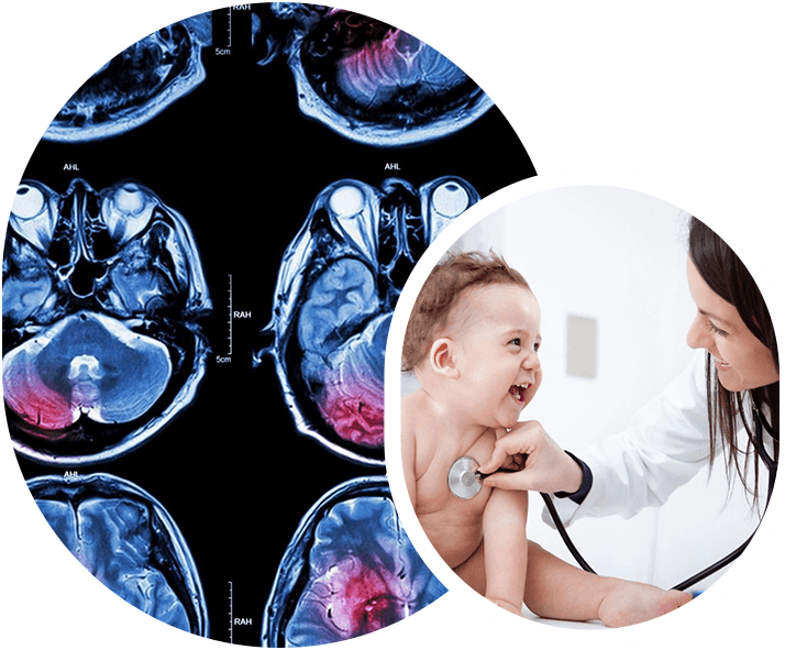 A collage of photos with a baby and an mri image